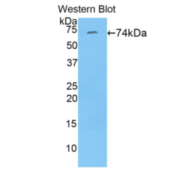 Fibulin 4 (FBLN4) Human Polyclonal Antibody