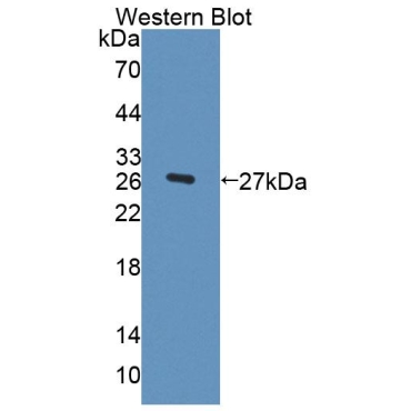 Fibulin 3 (FBLN3) Human Polyclonal Antibody