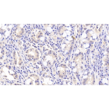Fibronectin Leucine Rich Transmembrane Protein 3 (FLRT3) Human Polyclonal Antibody