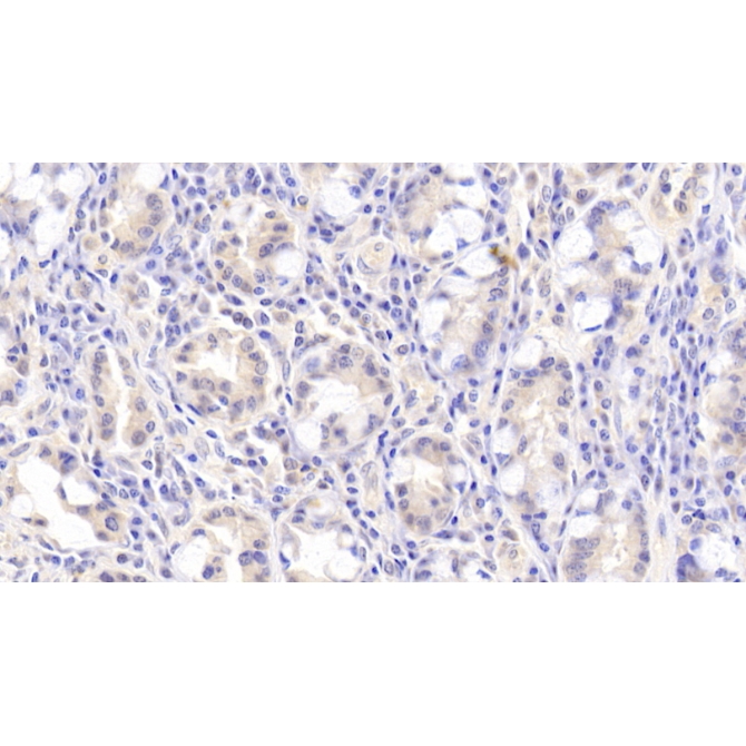 Fibronectin Leucine Rich Transmembrane Protein 3 (FLRT3) Human Polyclonal Antibody