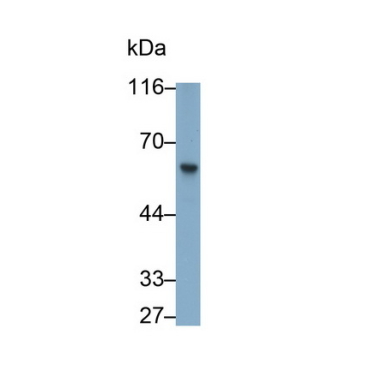 Flavin Containing Monooxygenase 3 (FMO3) Human Polyclonal Antibody