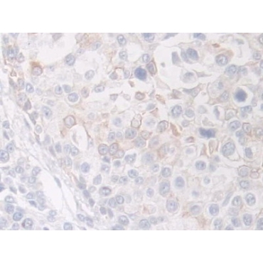 Flavin Containing Monooxygenase 1 (FMO1) Human Polyclonal Antibody