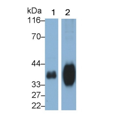 Folate Receptor 1, Adult (FOLR1) Human Polyclonal Antibody