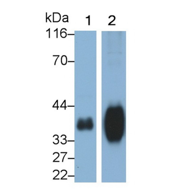 Folate Receptor 1, Adult (FOLR1) Human Polyclonal Antibody