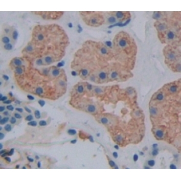 Centaurin Alpha 2 (CENTa2) Human Polyclonal Antibody
