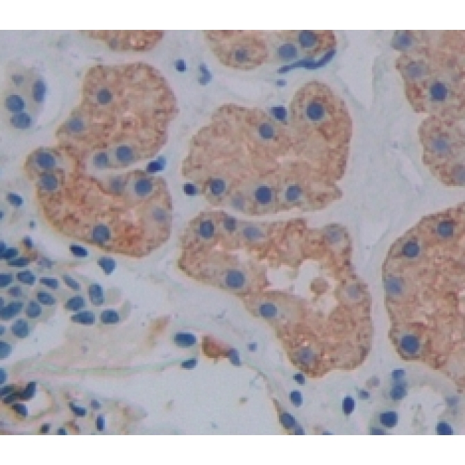 Centaurin Alpha 2 (CENTa2) Human Polyclonal Antibody