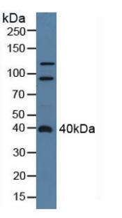 Centaurin Alpha 2 (CENTa2) Rat Polyclonal Antibody