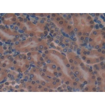 Growth Factor Receptor Bound Protein 7 (Grb7) Mouse Polyclonal Antibody