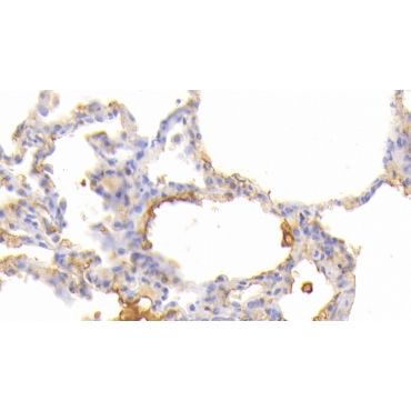 Janus Kinase 3 (JAK3) Human Polyclonal Antibody