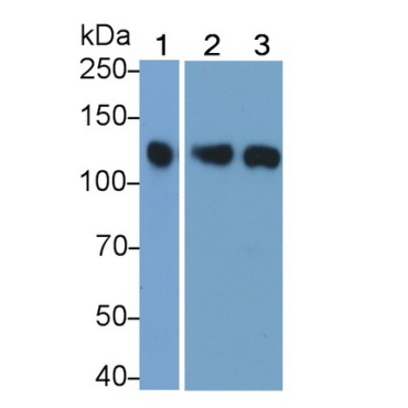 Janus Kinase 3 (JAK3) Mouse Polyclonal Antibody