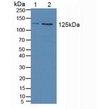 Janus Kinase 2 (JAK2) Human Polyclonal Antibody