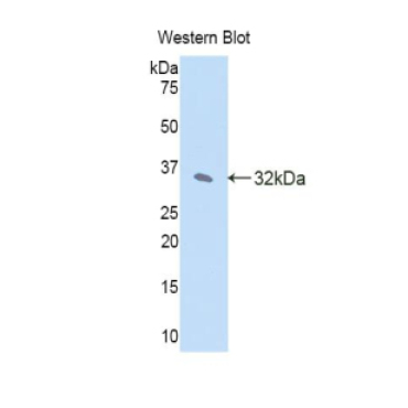 Janus Kinase 2 (JAK2) Mouse Polyclonal Antibody