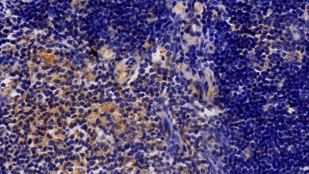 Janus Kinase 2 (JAK2) Rat Polyclonal Antibody