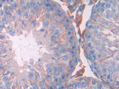 Janus Kinase 2 (JAK2) Rat Polyclonal Antibody