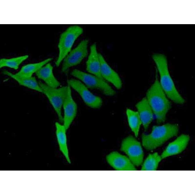 Kinesin Family, Member 5A (KIF5A) Human Polyclonal Antibody