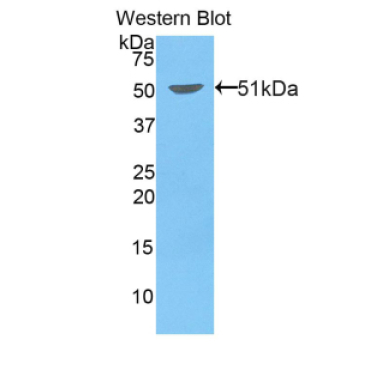 Kinesin Family, Member 5A (KIF5A) Mouse Polyclonal Antibody