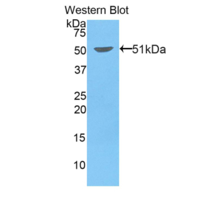 Kinesin Family, Member 5A (KIF5A) Mouse Polyclonal Antibody
