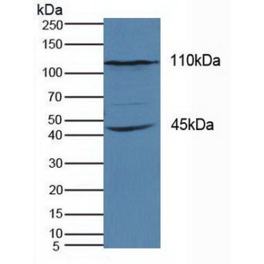 Kinesin Family, Member 18A (KIF18A) Human Polyclonal Antibody