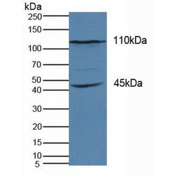 Kinesin Family, Member 18A (KIF18A) Human Polyclonal Antibody