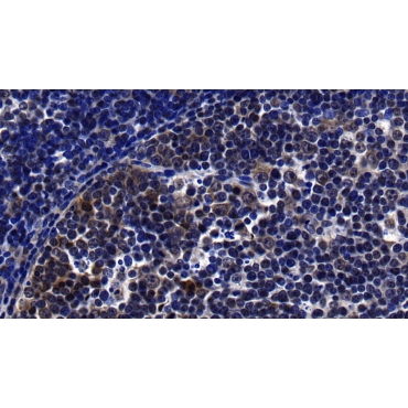 Leukocyte Cell Derived Chemotaxin 2 (LECT2) Human Polyclonal Antibody