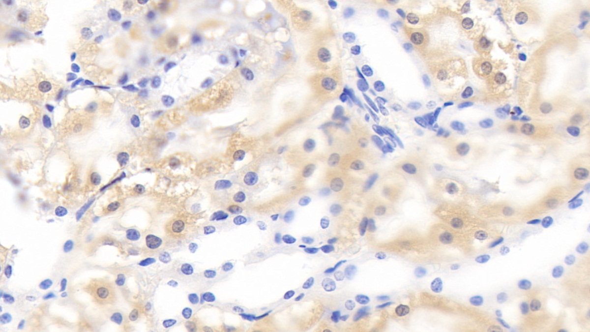Leukocyte Cell Derived Chemotaxin 2 (LECT2) Rat Polyclonal Antibody