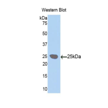 Lysyl Oxidase Like Protein 1 (LOXL1) Human Polyclonal Antibody