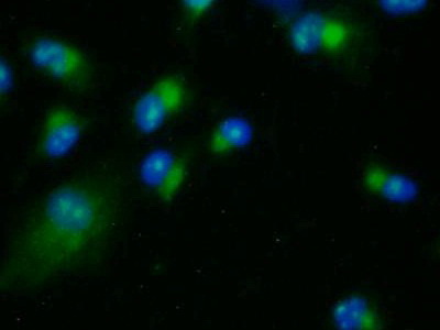 Lysyl Oxidase Like Protein 2 (LOXL2) Rat Polyclonal Antibody
