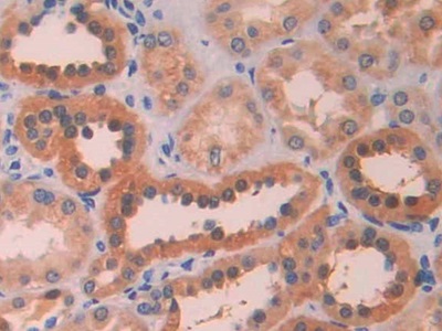 Lysyl Oxidase Like Protein 4 (LOXL4) Human Polyclonal Antibody