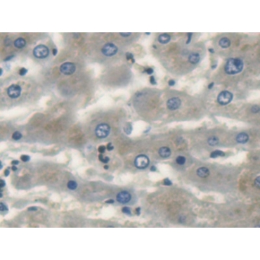 Uncoupling Protein 1, Mitochondrial (UCP1) Human Polyclonal Antibody