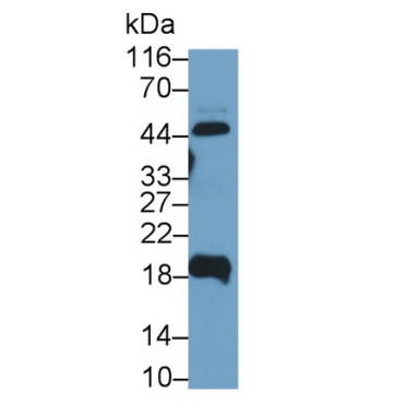 Uroplakin 2 (UPK2) Human Polyclonal Antibody