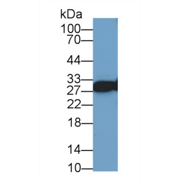 Vesicle Associated Membrane Protein Associated Protein A (VAPA) Human Polyclonal Antibody