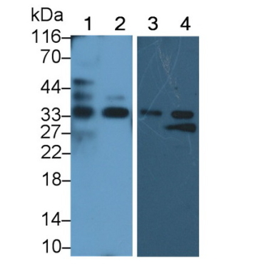 Vanin 2 (VNN2) Human Polyclonal Antibody
