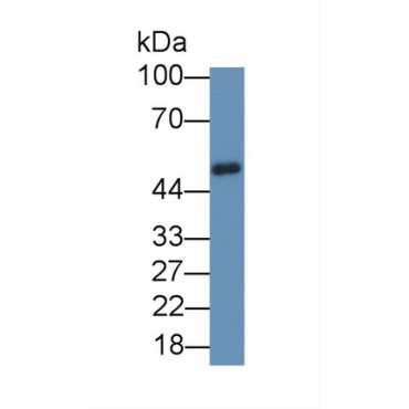 Zinc Finger Protein 2 (ZNF2) Human Polyclonal Antibody
