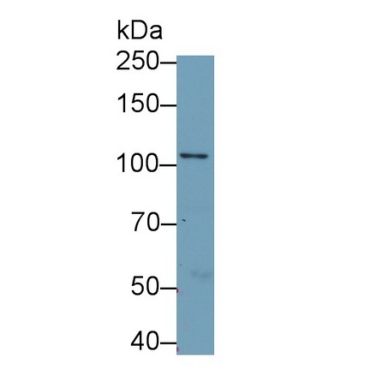 Multimerin 2 (MMRN2) Human Polyclonal Antibody