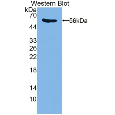 Phosphodiesterase 4D, cAMP Specific (PDE4D) Human Polyclonal Antibody