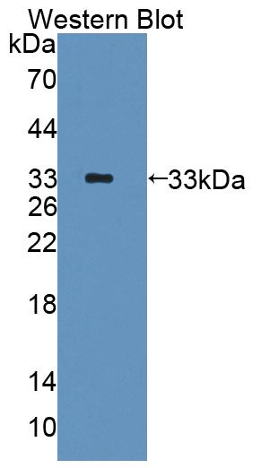 Phosphodiesterase 10A (PDE10A) Human Polyclonal Antibody