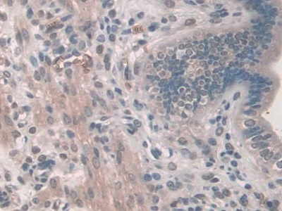 Phosphodiesterase 12 (PDE12) Mouse Polyclonal Antibody