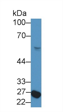 Nuclear Factor I/X (NFIX) Rat Polyclonal Antibody