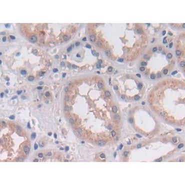 2',5'-Oligoadenylate Synthetase 2 (OAS2) Human Polyclonal Antibody