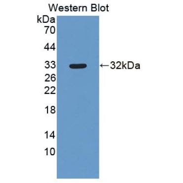 2',5'-Oligoadenylate Synthetase Like Protein (OASL) Human Polyclonal Antibody