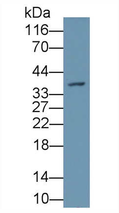 Peptidyl Arginine Deiminase Type III (PADI3) Human Polyclonal Antibody