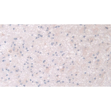Pantothenate Kinase 4 (PANK4) Human Polyclonal Antibody