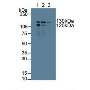 Polymerase DNA Directed Gamma 1 (POLg1) Human Polyclonal Antibody