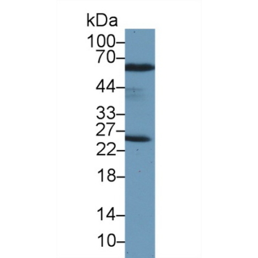 Peroxiredoxin 6 (PRDX6) Human Polyclonal Antibody
