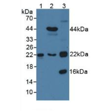 Transgelin 2 (TAGLN2) Human Polyclonal Antibody