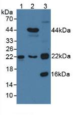 Transgelin 2 (TAGLN2) Human Polyclonal Antibody