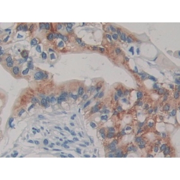 Transmembrane Protease, Serine 4 (TMPRSS4) Human Polyclonal Antibody