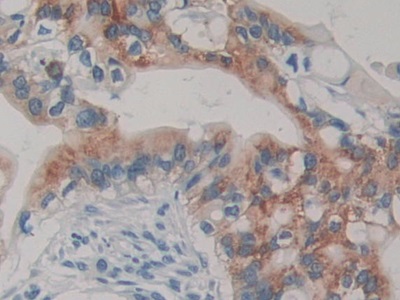 Transmembrane Protease, Serine 4 (TMPRSS4) Human Polyclonal Antibody