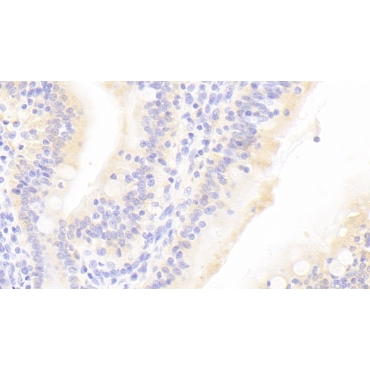 Taste Receptor Type 2 Member 38 (TAS2R38) Human Polyclonal Antibody