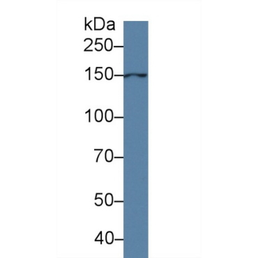 Anoctamin 6 (ANO6) Human Polyclonal Antibody